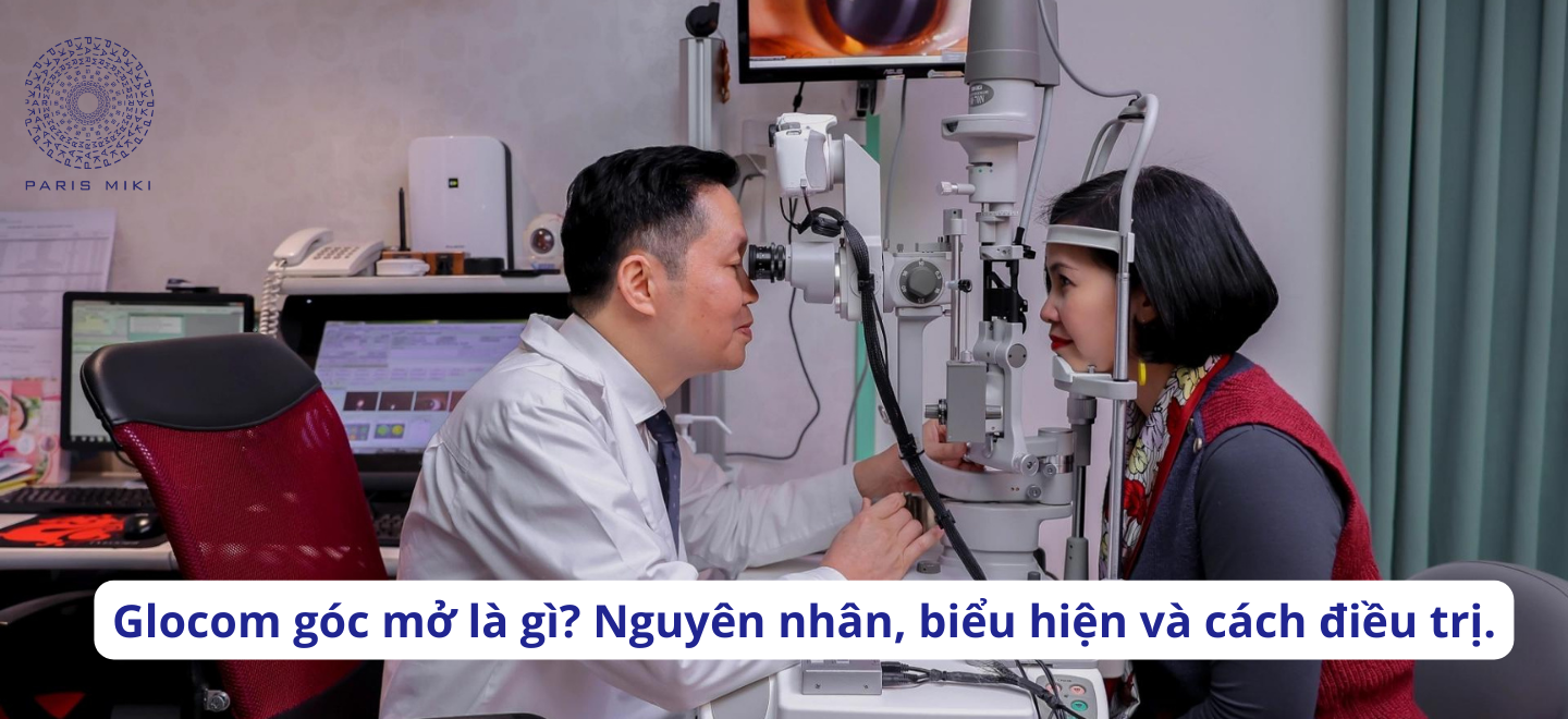 Glocom góc mở là gì? Nguyên nhân, biểu hiện và cách điều trị.
