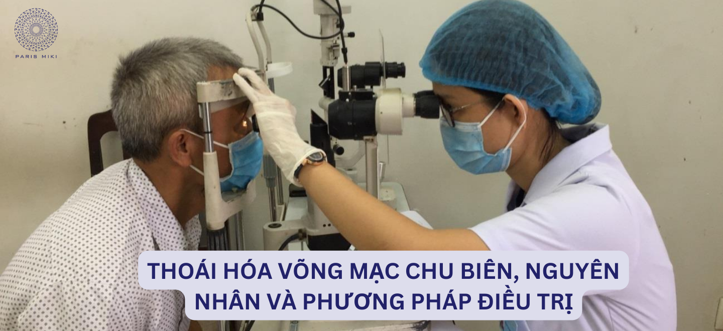 Thoái hóa võng mạc chu biên, nguyên nhân và phương pháp điều trị