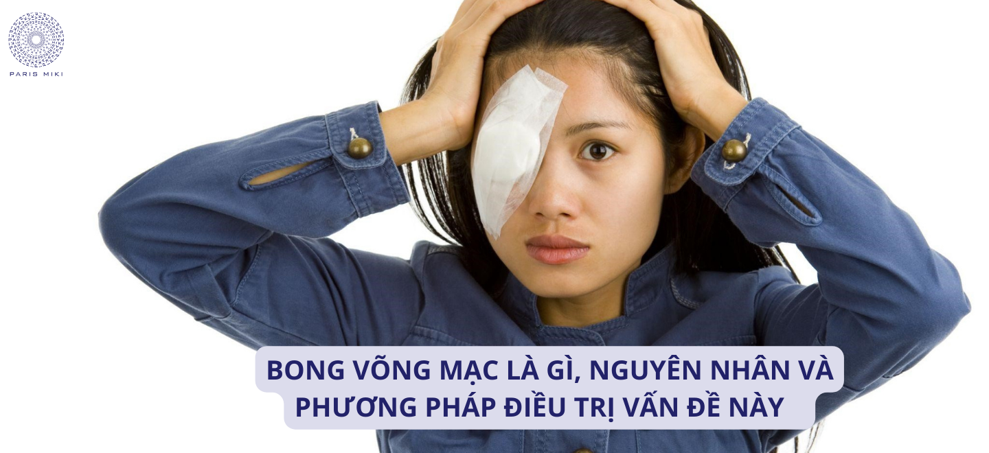 Bong võng mạc là gì, nguyên nhân và phương pháp điều trị vấn đề này