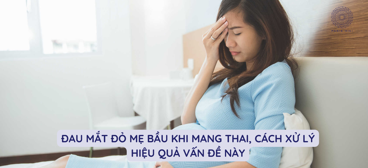 Đau mắt đỏ mẹ bầu khi mang thai, cách xử lý hiệu quả vấn đề này