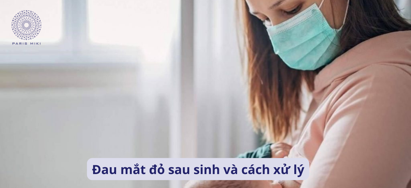 Đau mắt đỏ sau sinh và cách xử lý