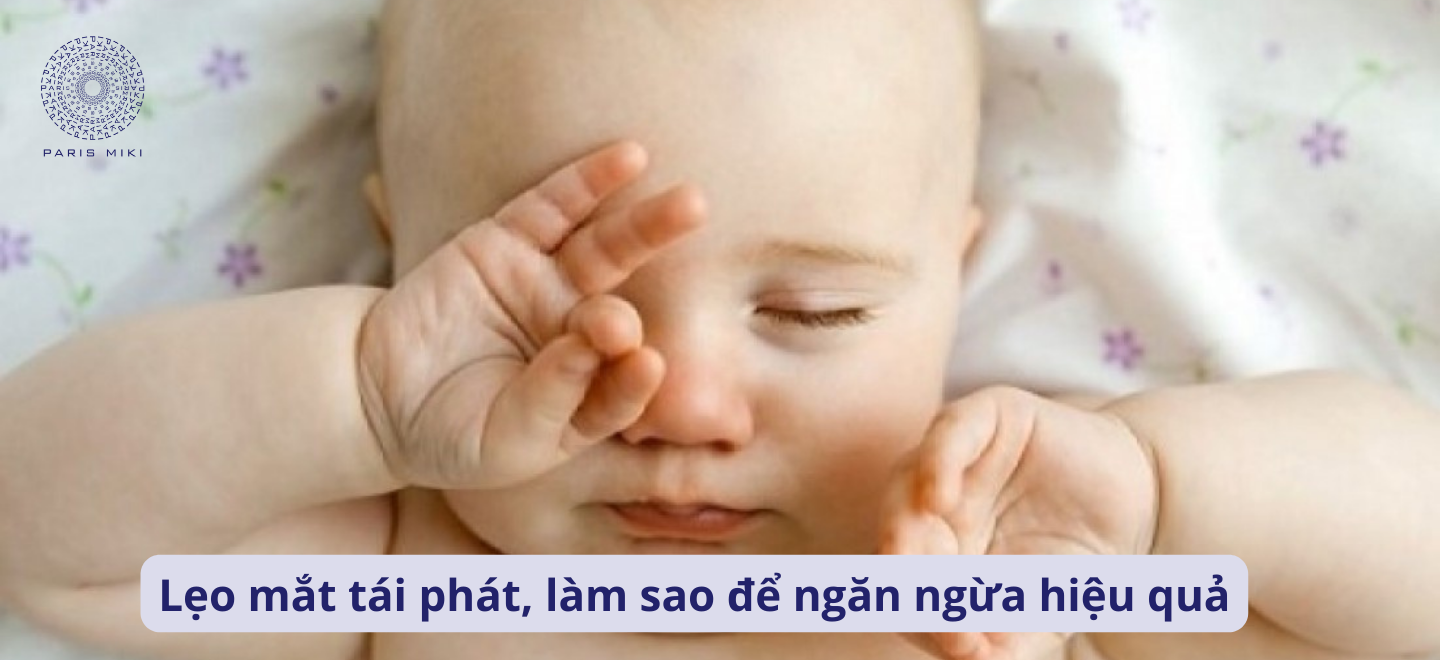 Lẹo mắt tái phát, làm sao để ngăn ngừa hiệu quả